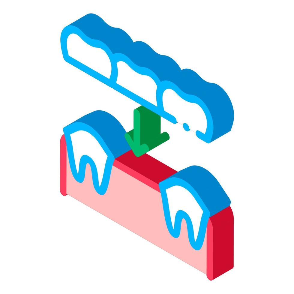 prótesis dental estomatología icono isométrico ilustración vectorial vector