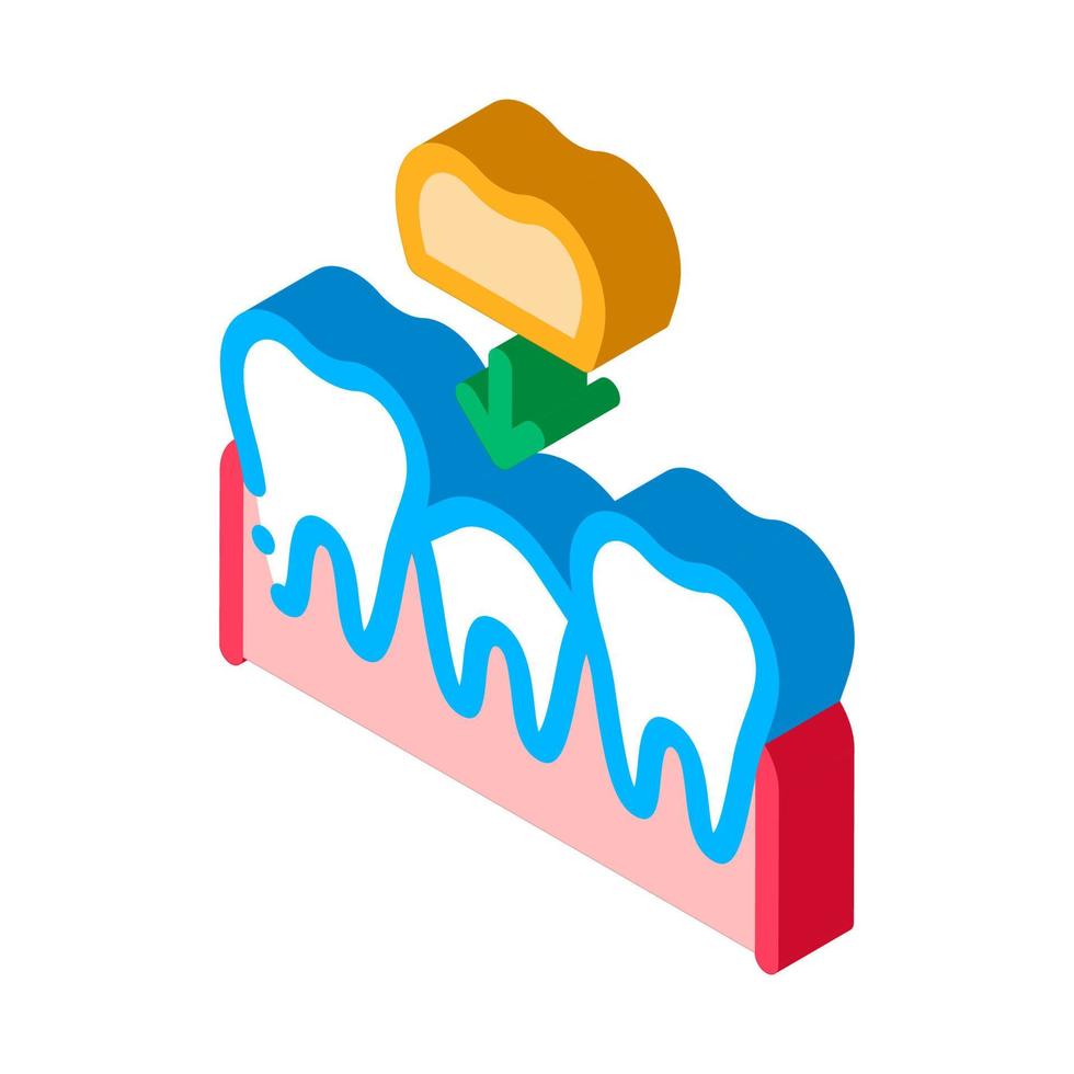 Ilustración de vector de icono isométrico de corona de diente de estomatología