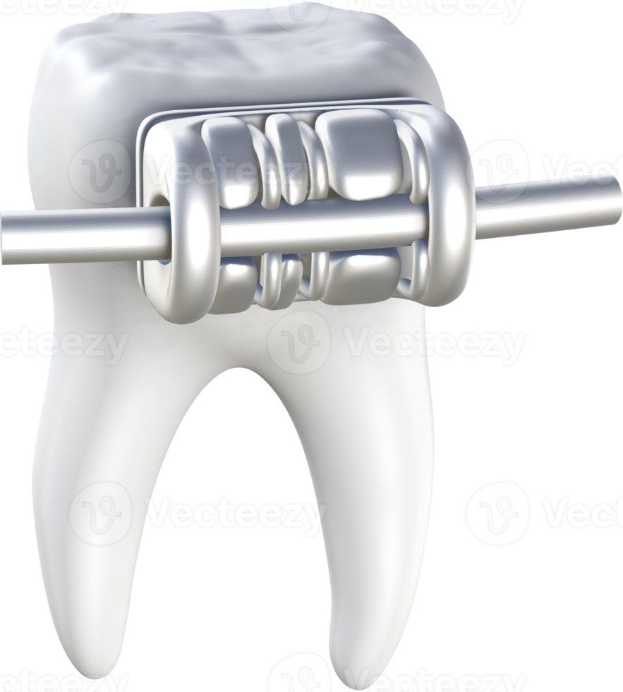 Dental braces 3D icon. png