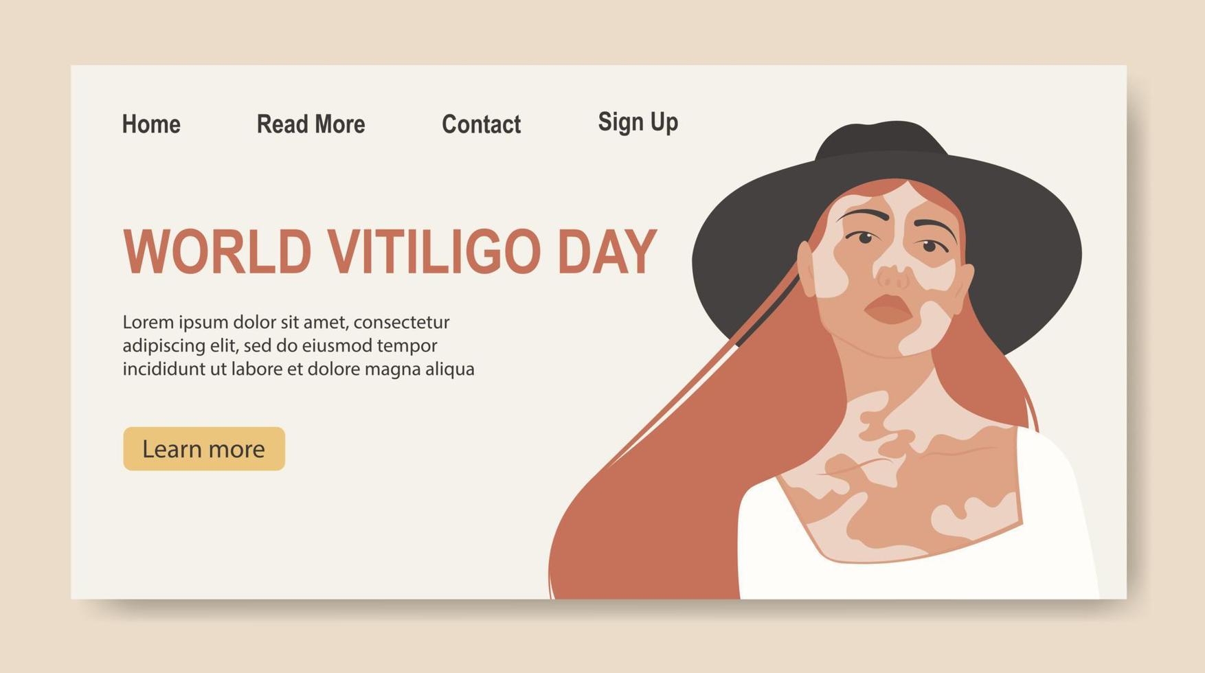 Young white girl illustration with vitiligo banner. World Vitiligo Day. Red hair cartoon woman. vector