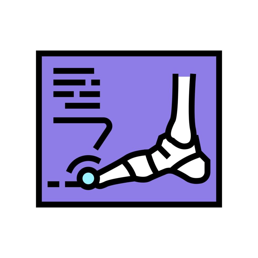 x-ray radiograph of foot gout diesase color icon vector illustration