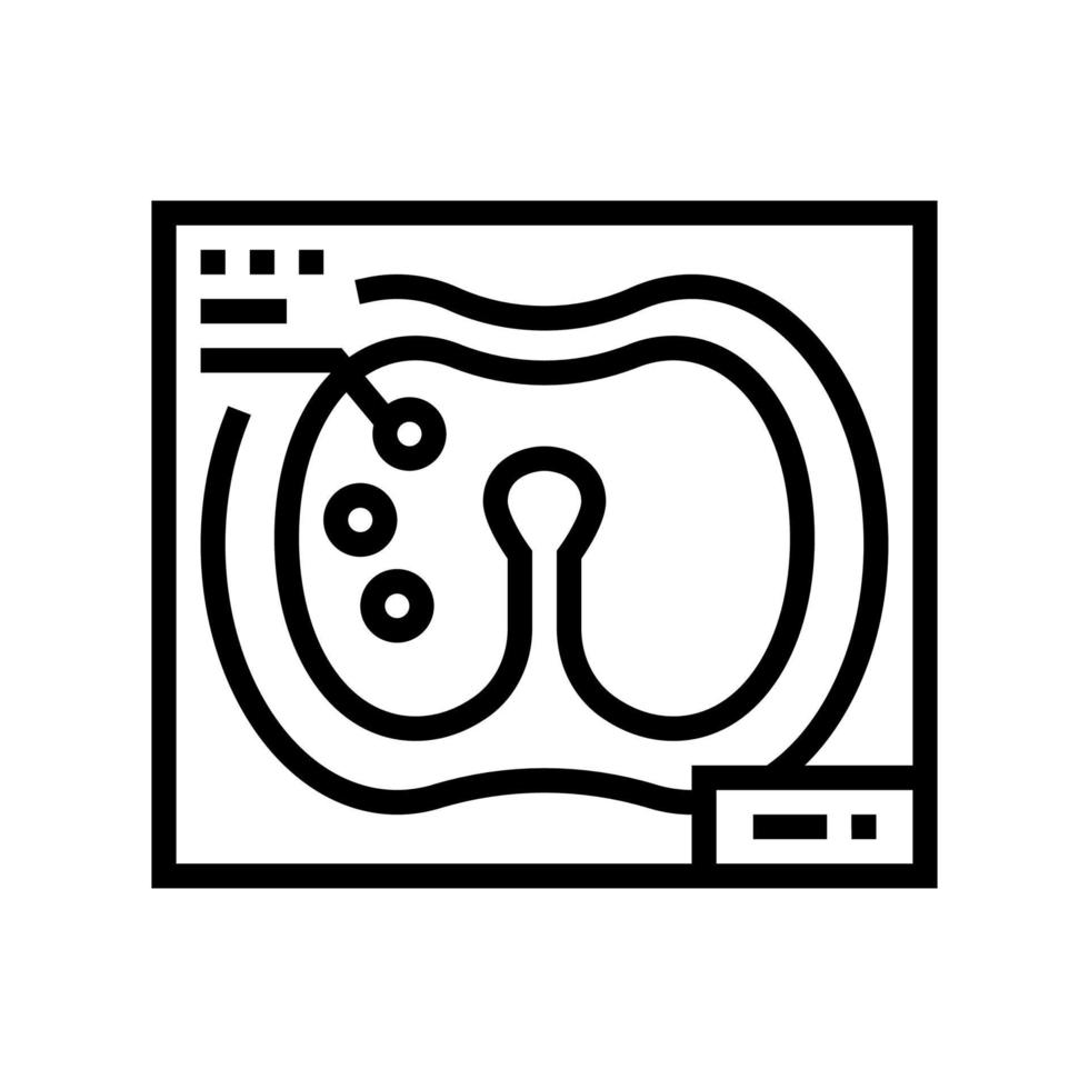 larynx x-ray line icon vector illustration