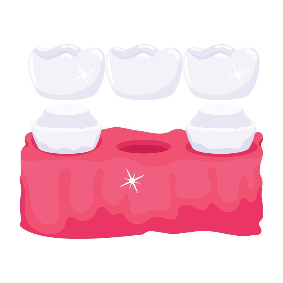 Trendy Dental Bridge vector