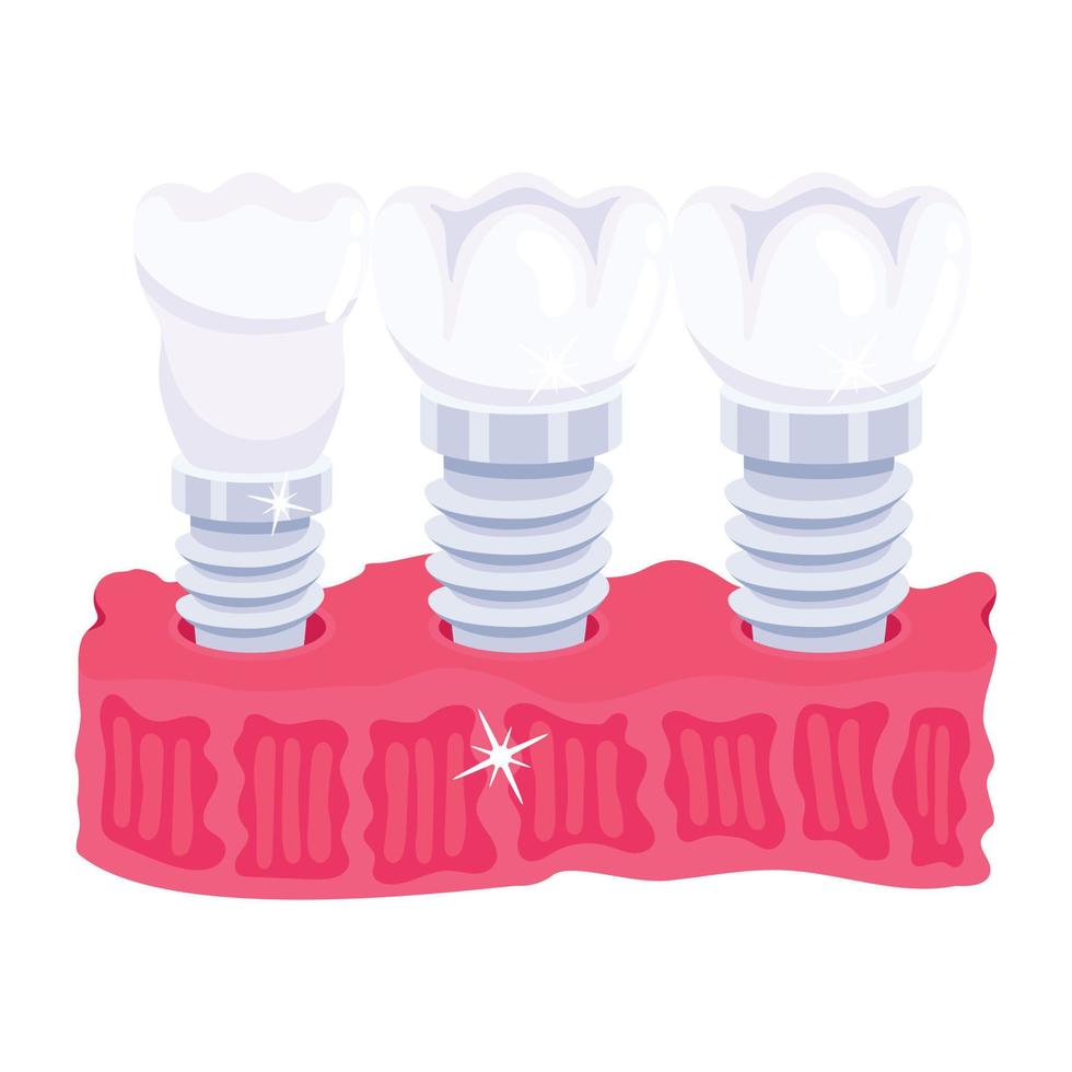 Trendy Endosseous Implant vector