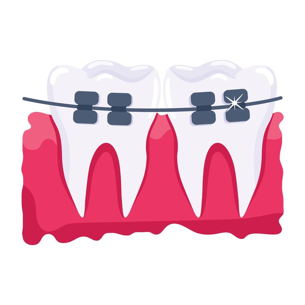 Trendy Braces Concepts vector