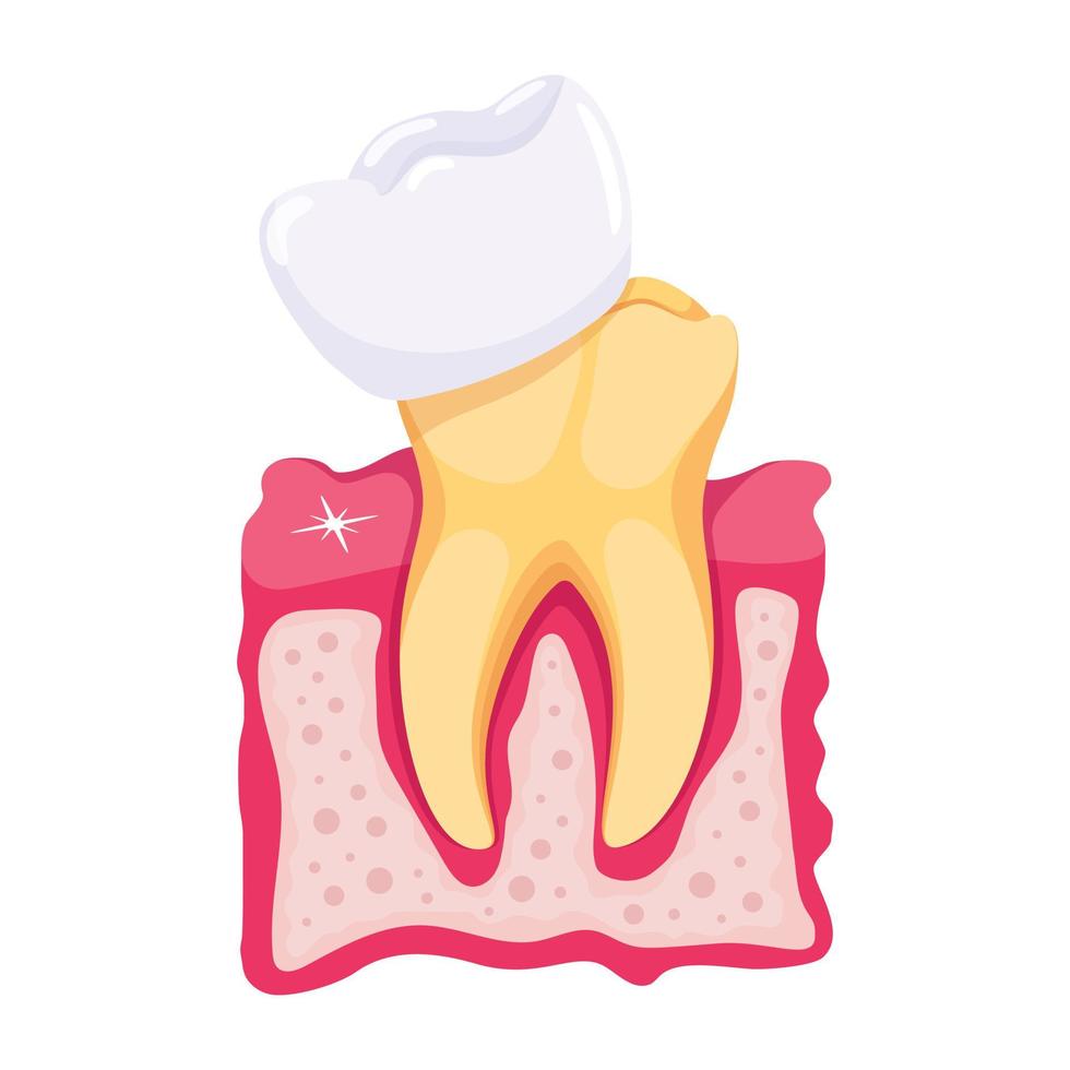 tratamientos dentales de moda vector