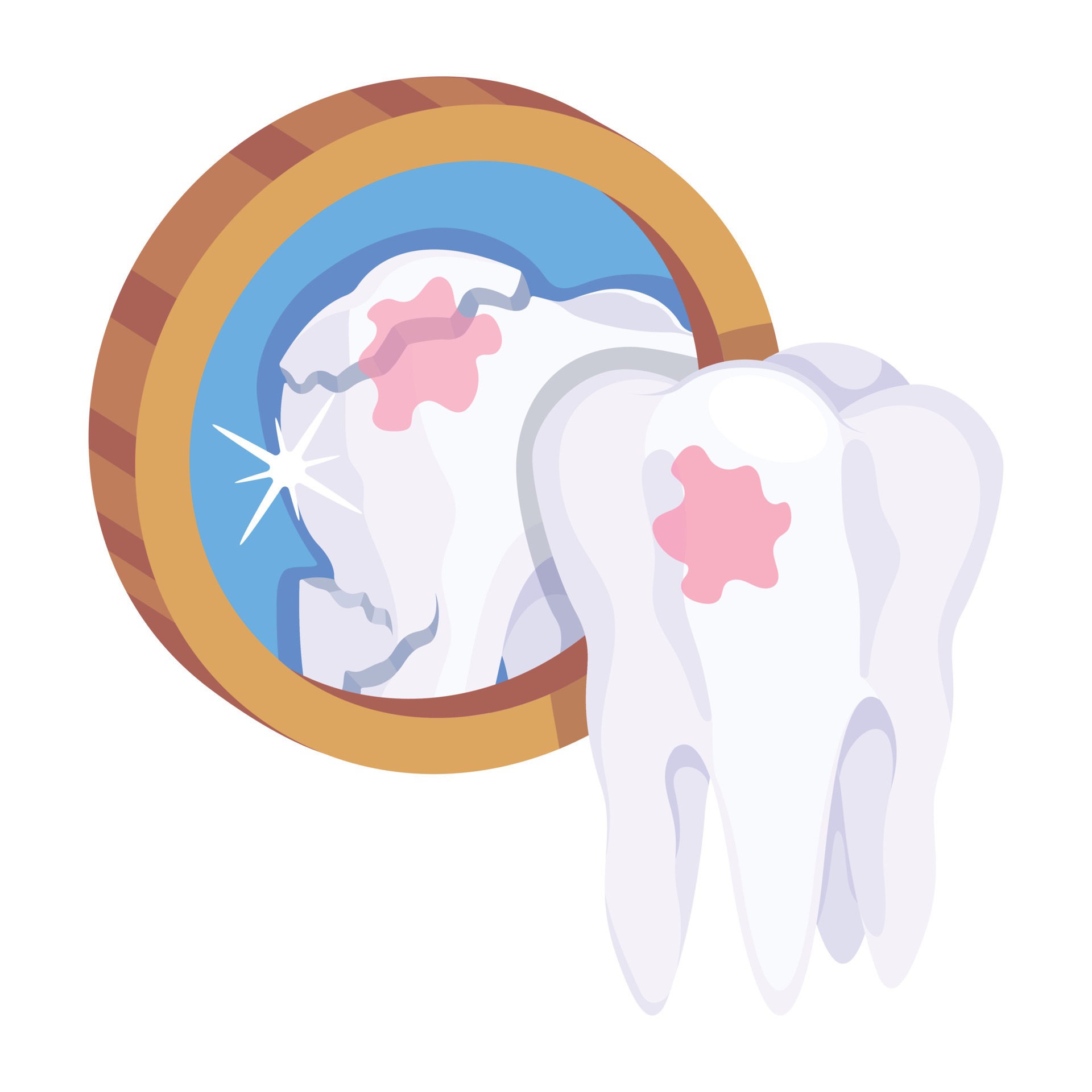 Trendy Dental Caries 18782724 Vector Art at Vecteezy