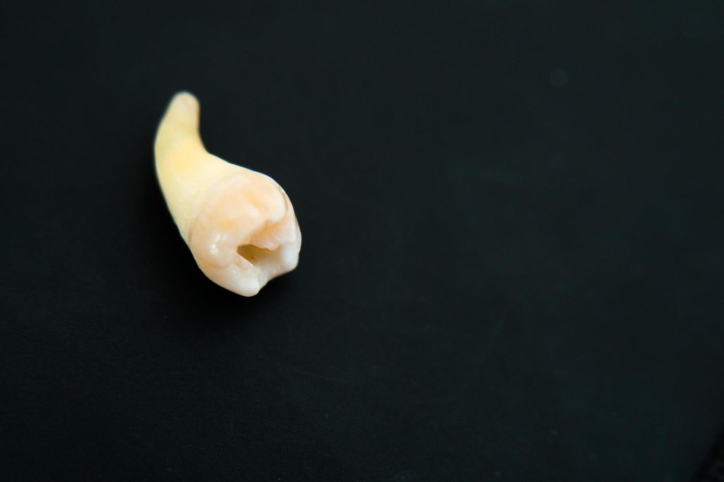 Close up of a cheektooth seen from above photo