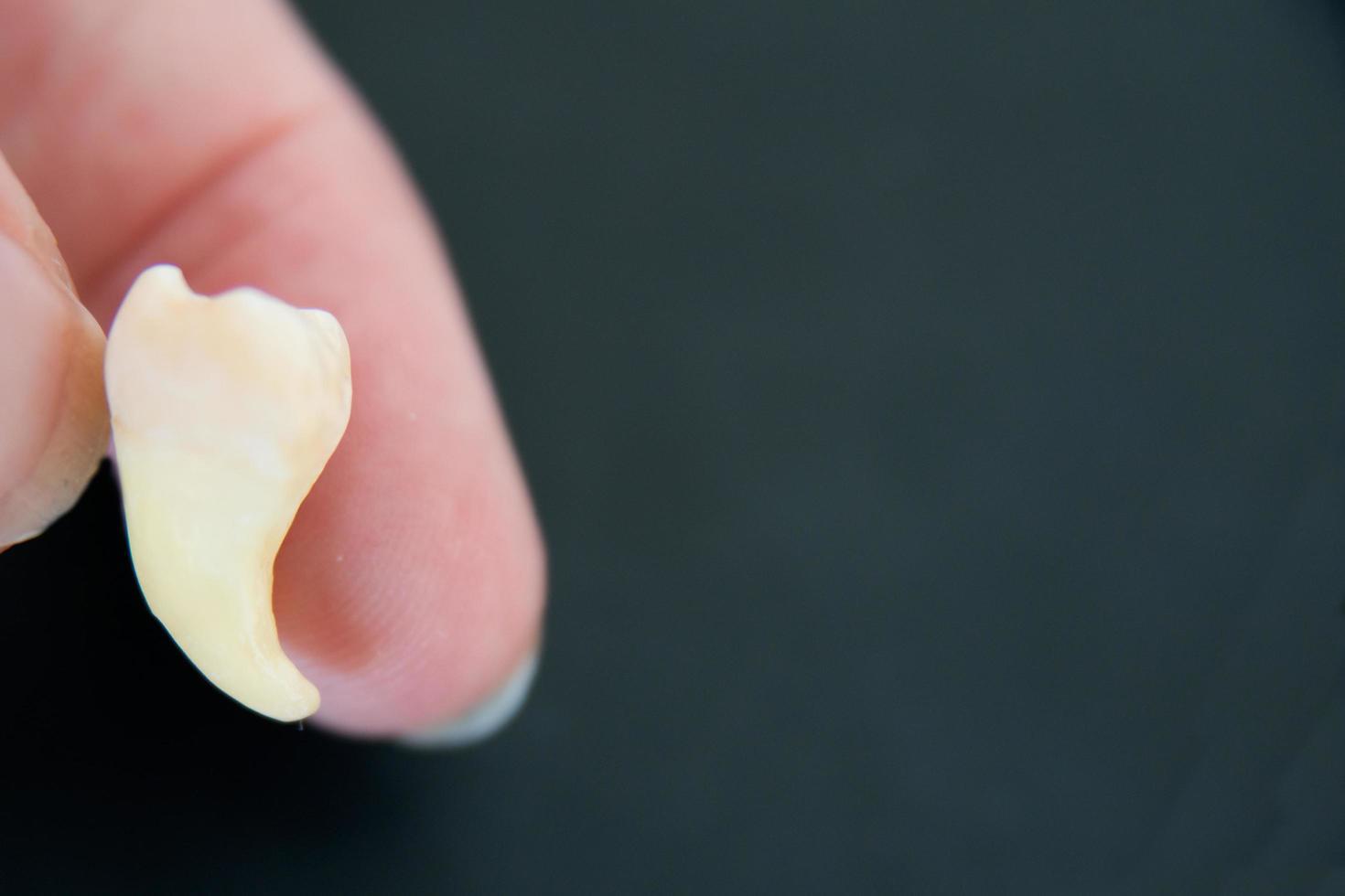 Caucasian human hand holding a cheektooth photo