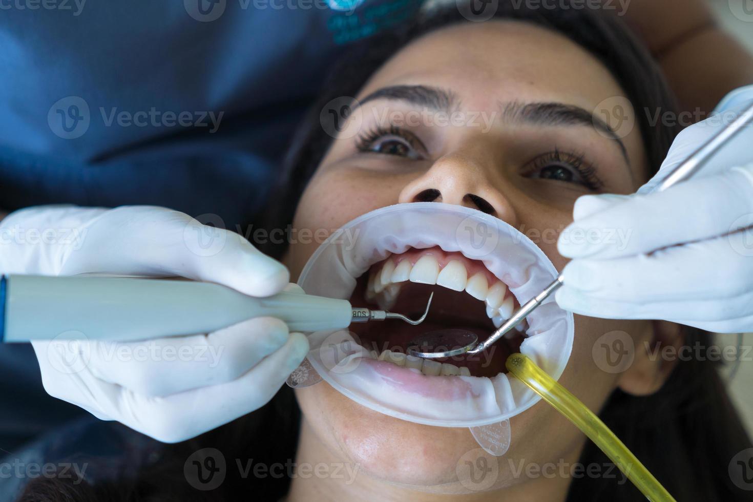 A woman's teeth are being treated at the clinic. photo