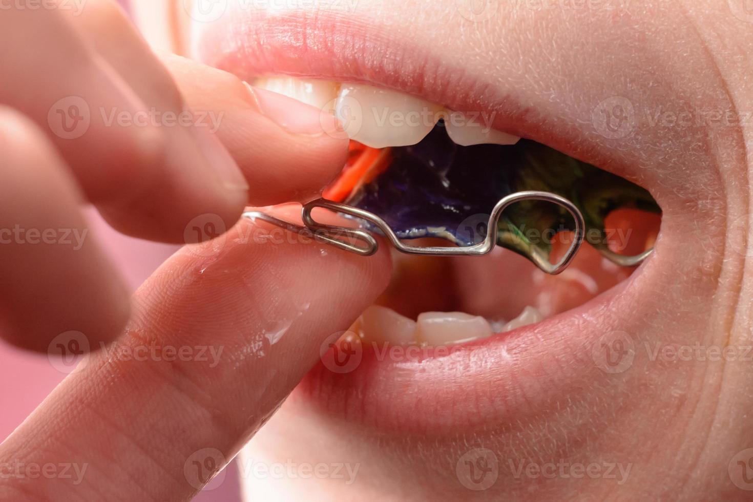 A big plan for dressing a metal plate for tooth bristling photo