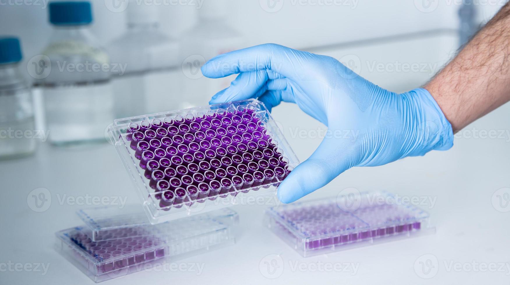 cell culture at the medicine, medical and cell culture laboratory photo