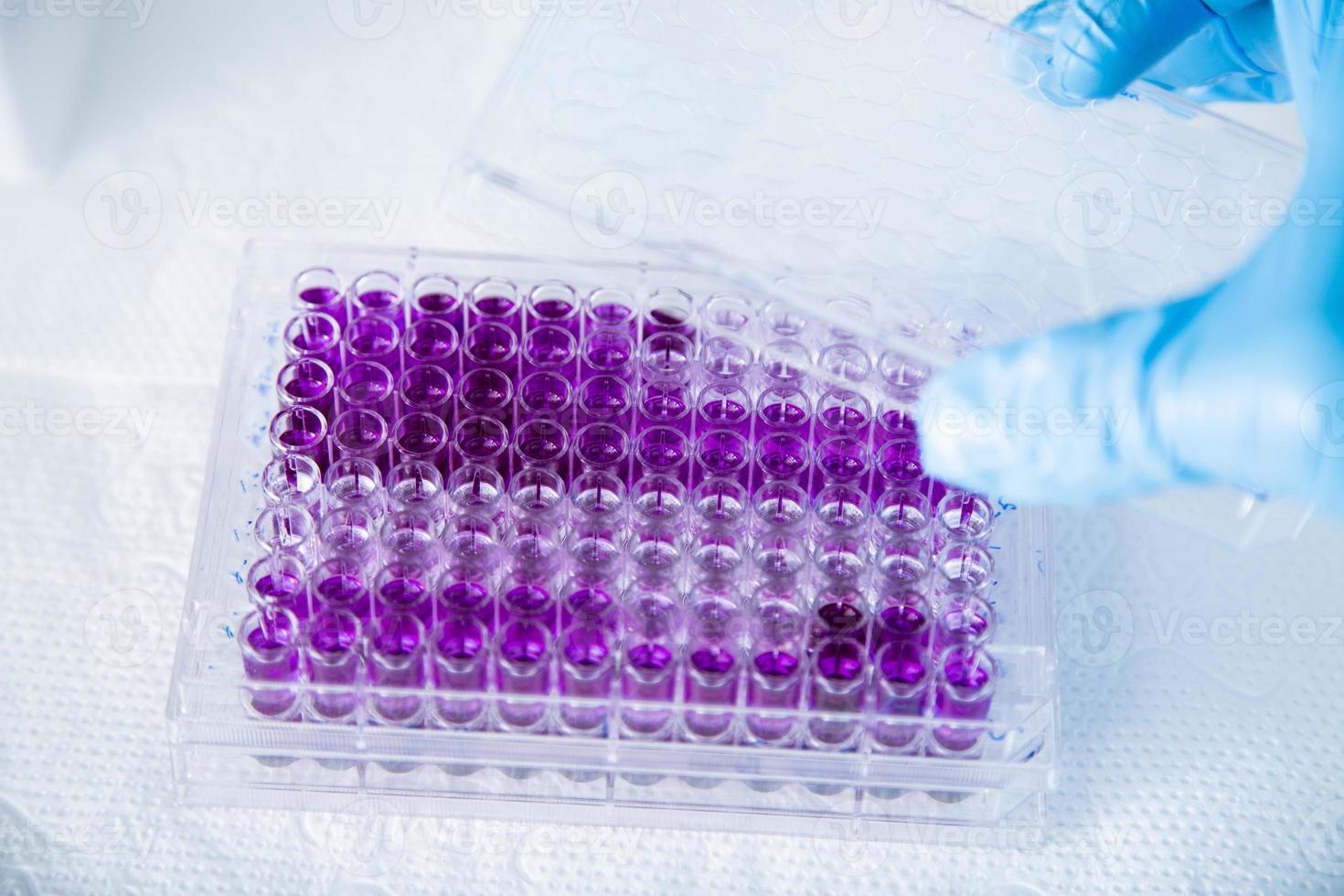 cell culture at the medicine, medical and cell culture laboratory photo