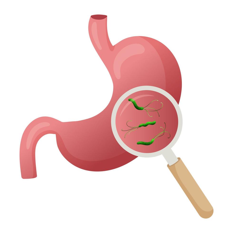 Helicobacter pylori in stomach under magnifying glass. Vector illustration, cartoon style