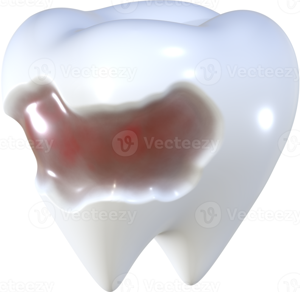 ilustración de icono 3d de caries dental. png