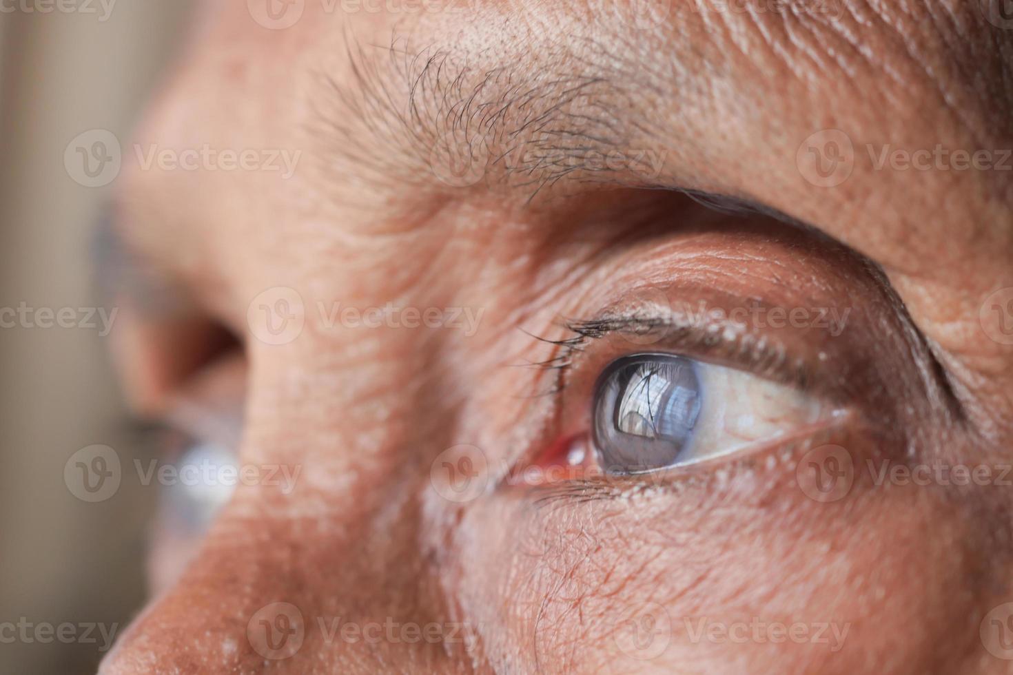 detail shot of asian senior women eye photo