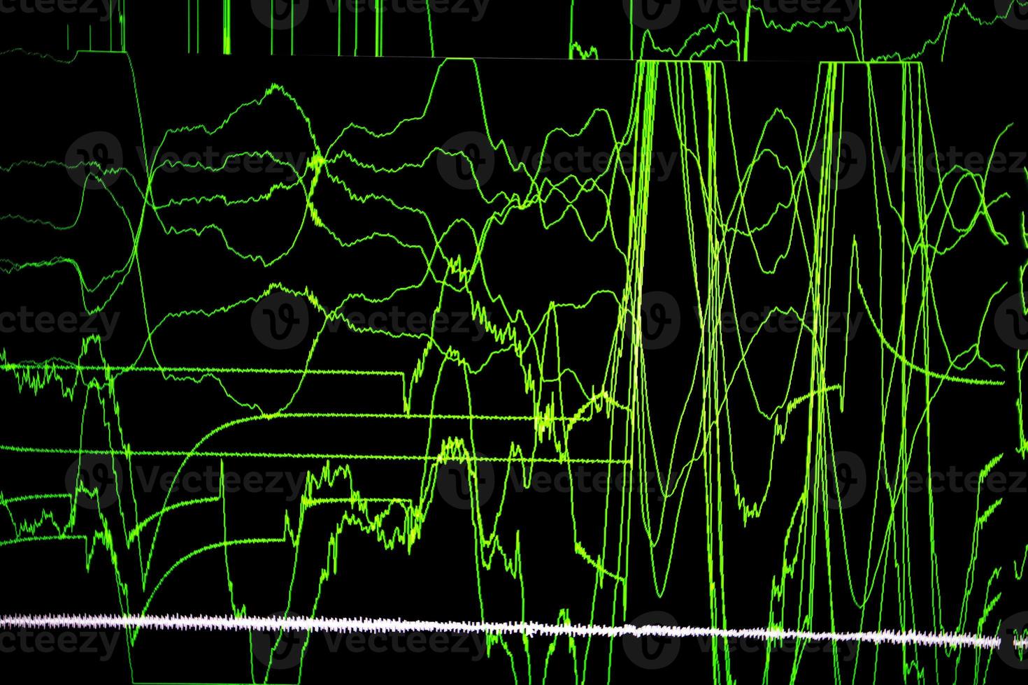 Medical background cardiogram on the monitor. photo