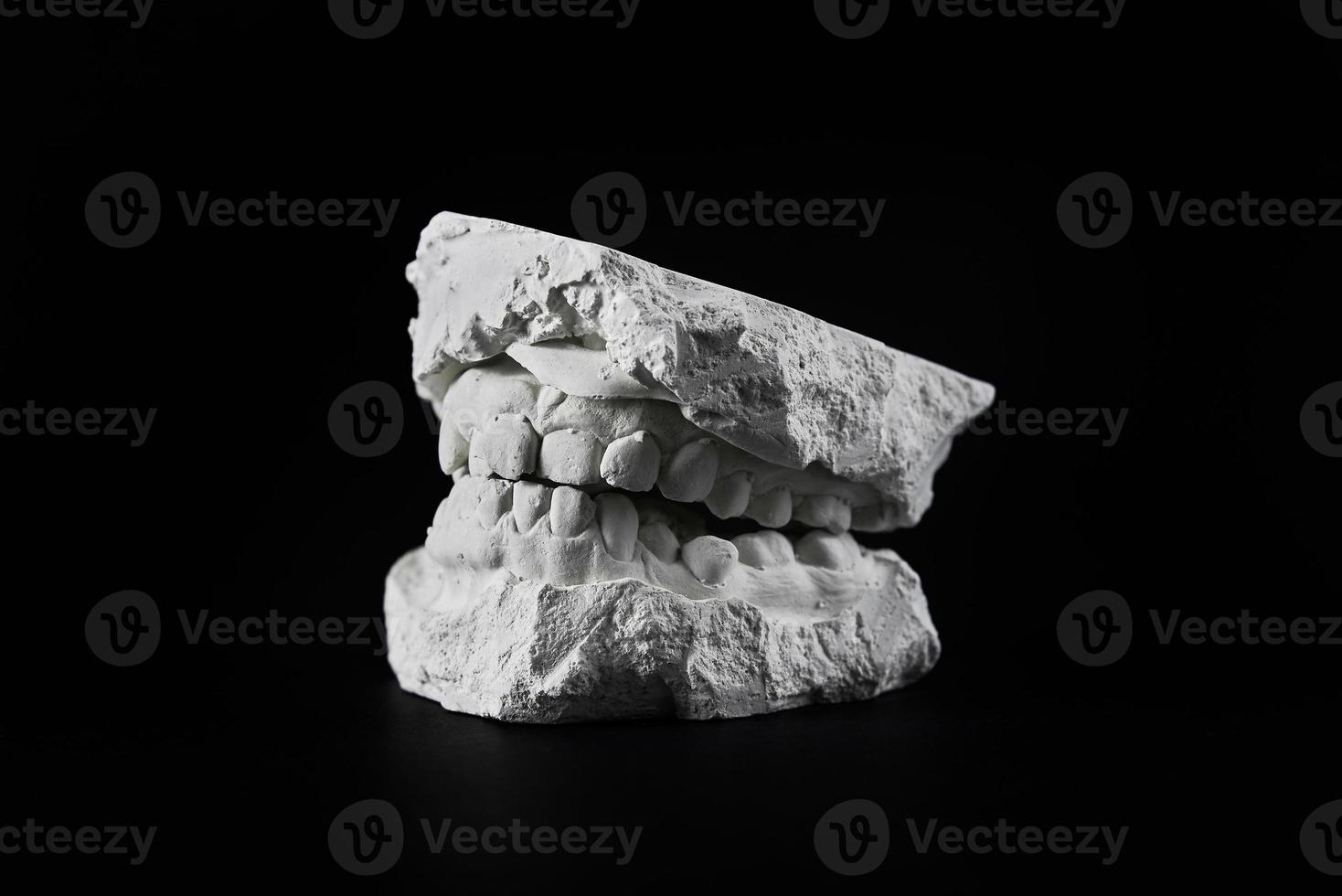 Teeth cast mold of the jaw made of plaster for orthodonist work photo