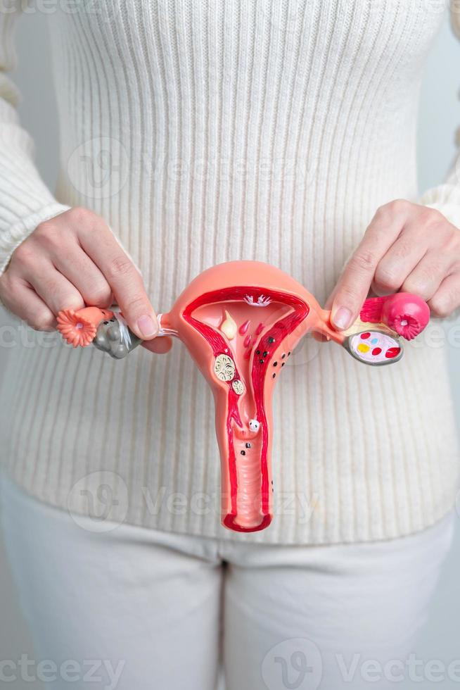 mujer sosteniendo modelo de útero y ovarios. cáncer de ovario y de cuello uterino, trastorno del cuello uterino, endometriosis, histerectomía, fibromas uterinos, sistema reproductivo y concepto de embarazo foto
