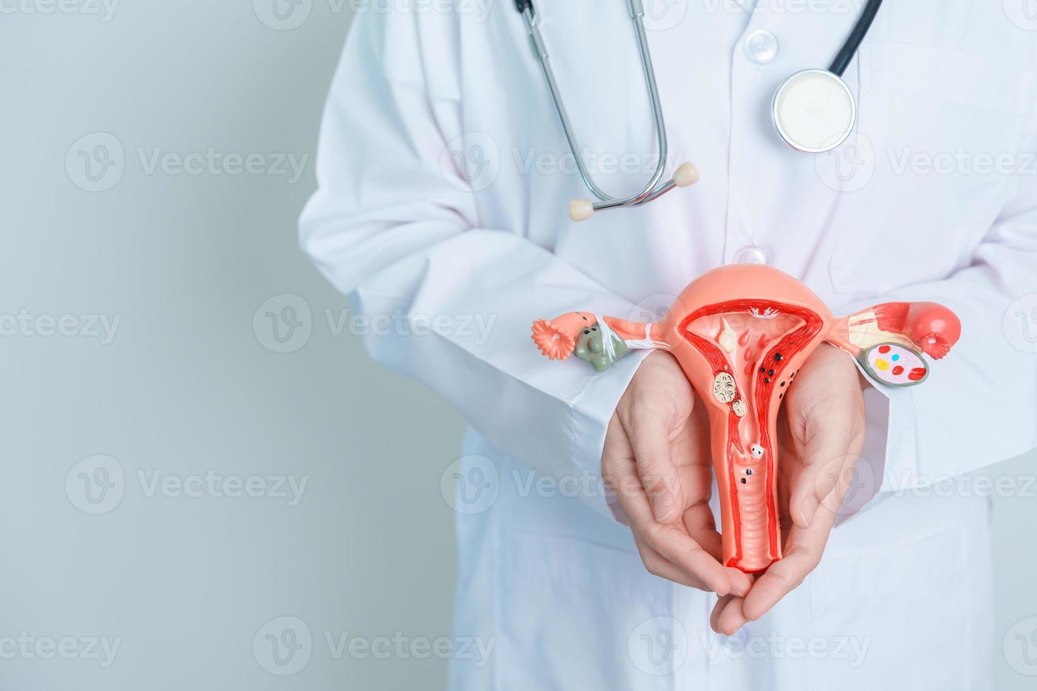 doctor sosteniendo modelo de útero y ovarios. cáncer de ovario y de cuello uterino, trastorno del cuello uterino, endometriosis, histerectomía, fibromas uterinos, sistema reproductivo y concepto de embarazo foto