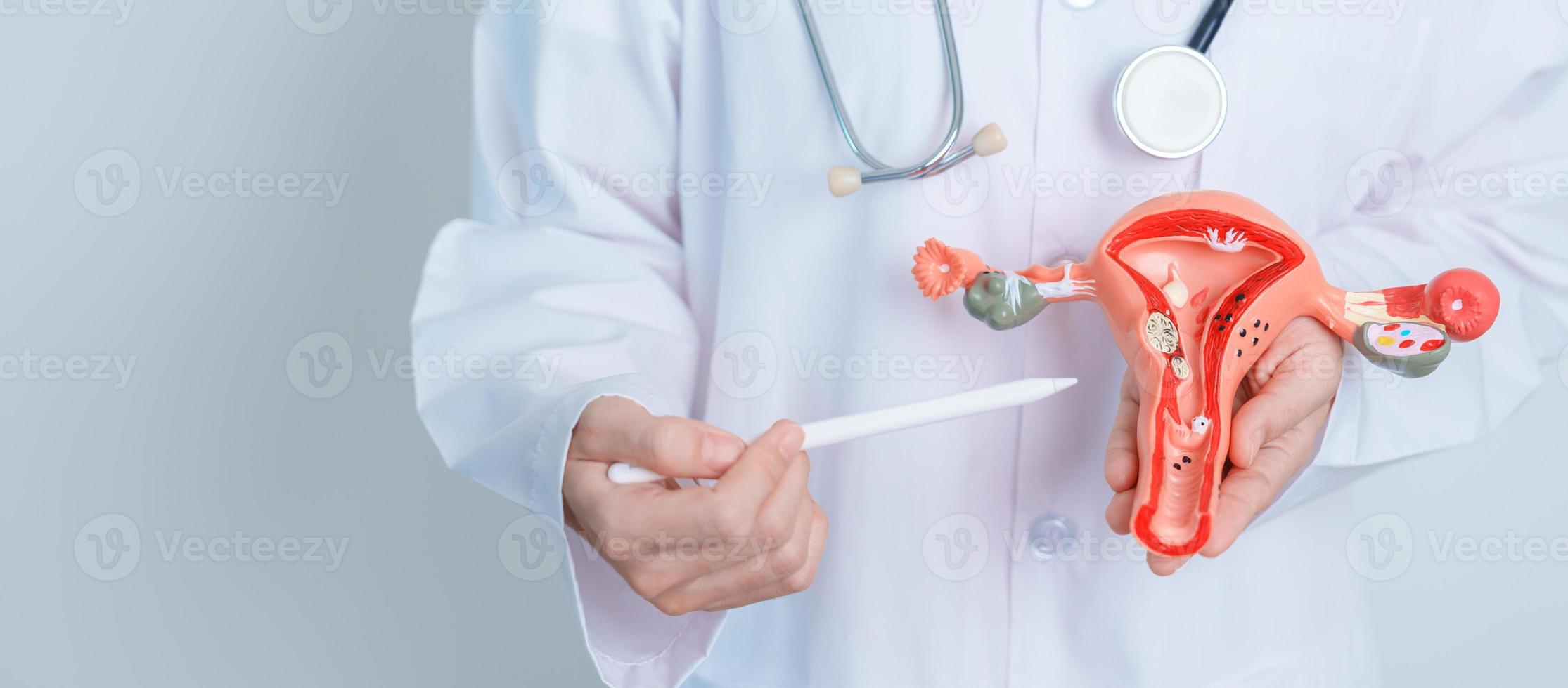 Doctor holding Uterus and Ovaries model. Ovarian and Cervical cancer, Cervix disorder, Endometriosis, Hysterectomy, Uterine fibroids, Reproductive system and Pregnancy concept photo
