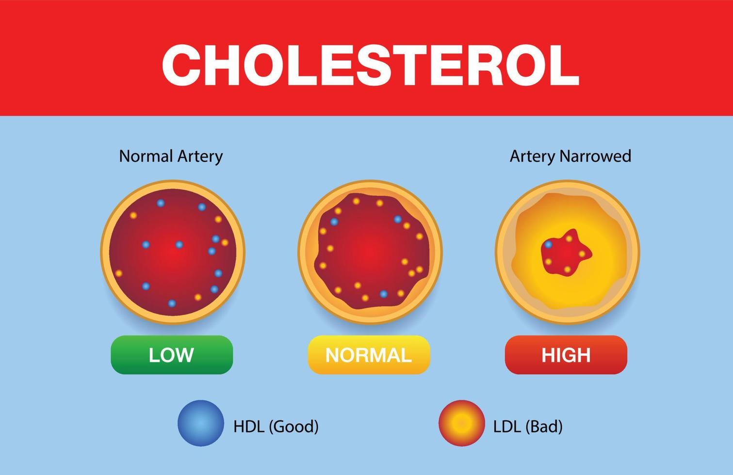 colesterol en la arteria, riesgo para la salud, diseño vectorial vector