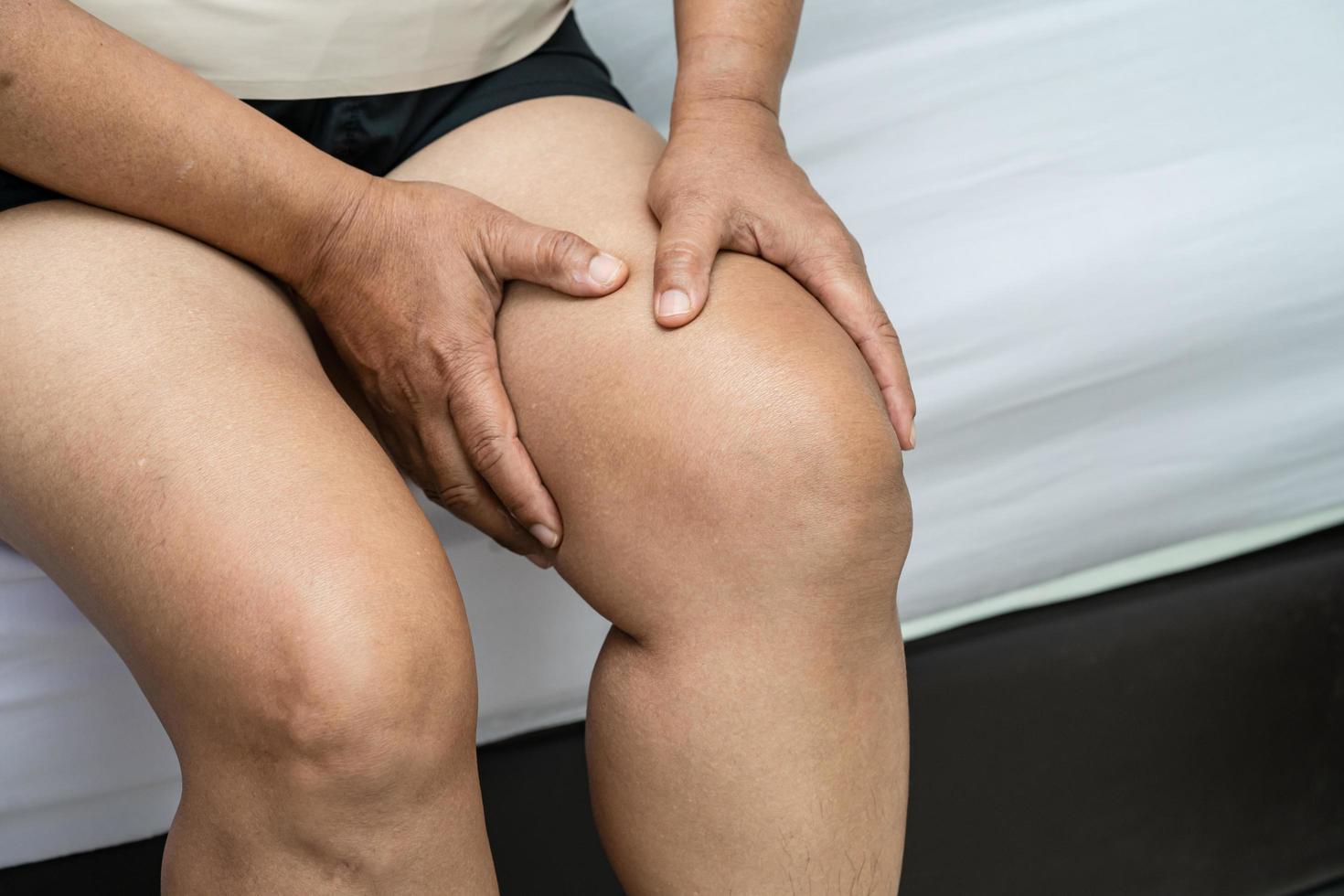 Asian lady woman patient touch and feel pain her knee, healthy medical concept. photo