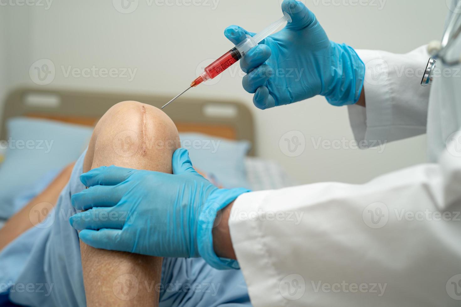 Asian doctor inject Hyaluronic acid platelet rich plasma into the knee of senior woman to walk without pain. photo