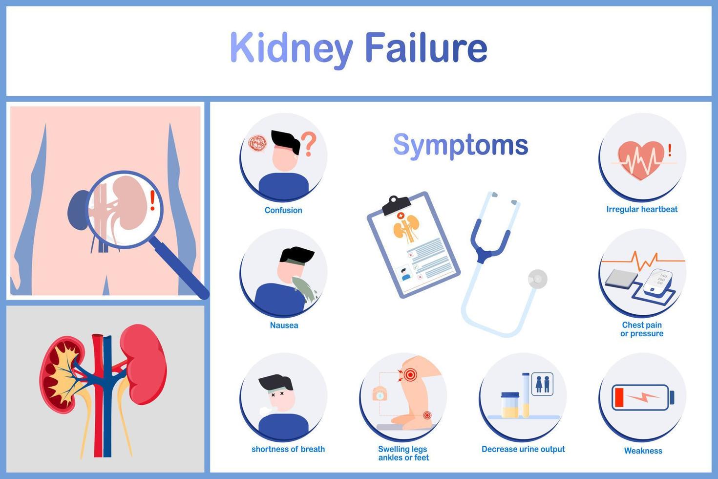 vector illustration.Symptoms of kidney failure incluing nausea and vomitting Irregular heartbeat,decreased urination,chest pain and pressure.including edema.flat stye.healthcare and medical concept.