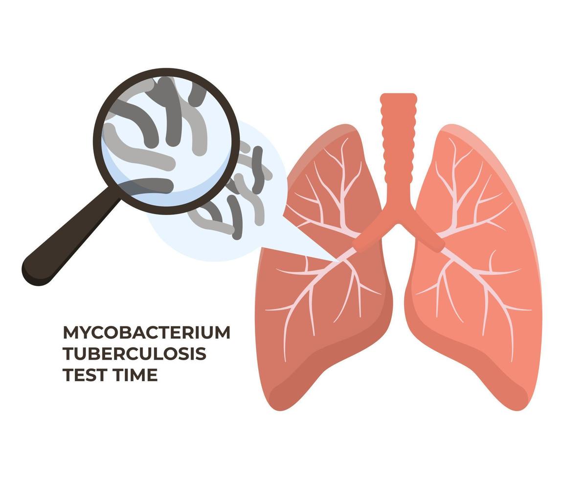 Human lungs with magnifying glass and tuberculosis bacterium. Anatomy, medicine concept. Healthcare. Vector illustration in flat style