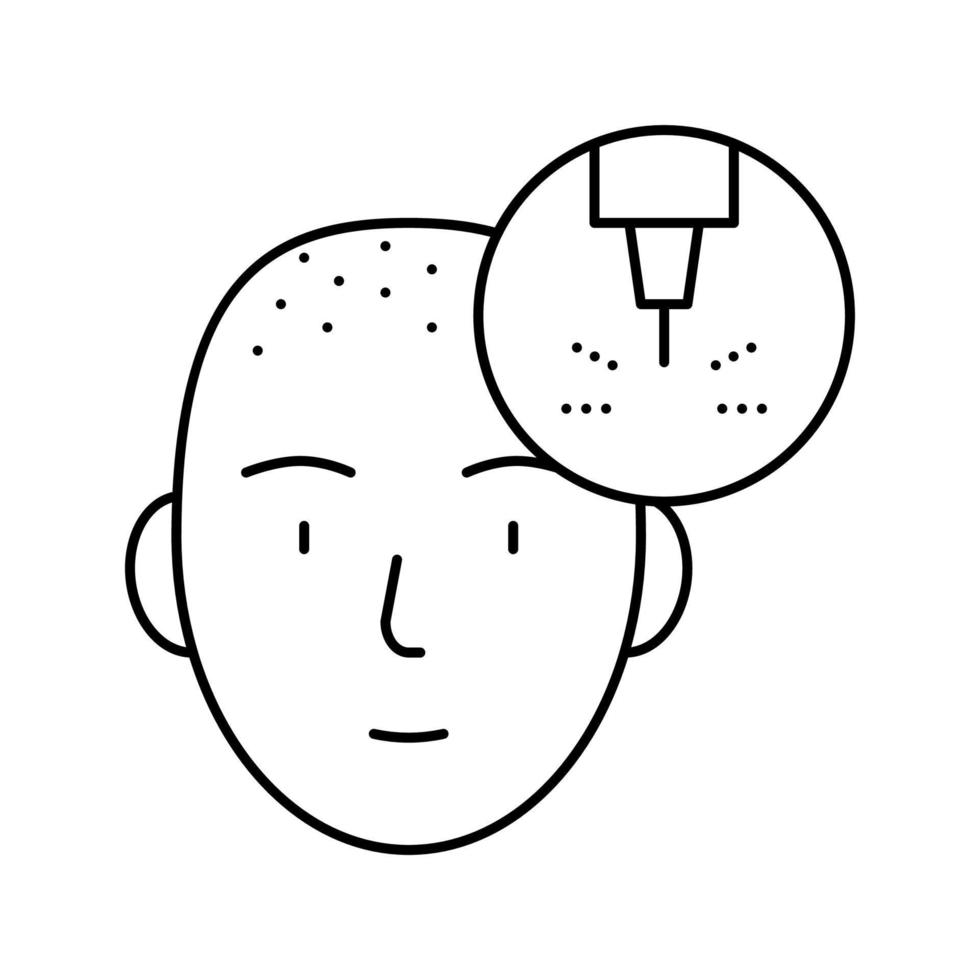 Ilustración de vector de icono de línea láser de extensión de cabello