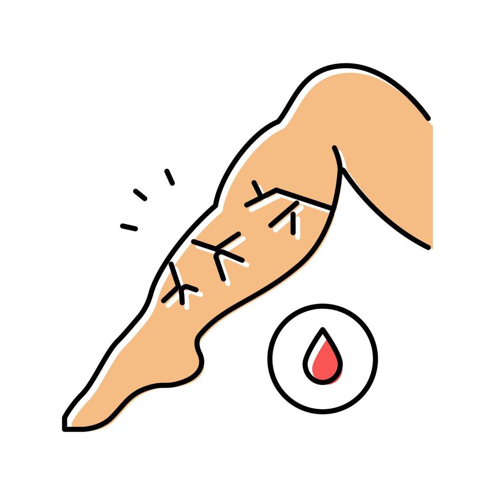 venous edema color icon vector illustration
