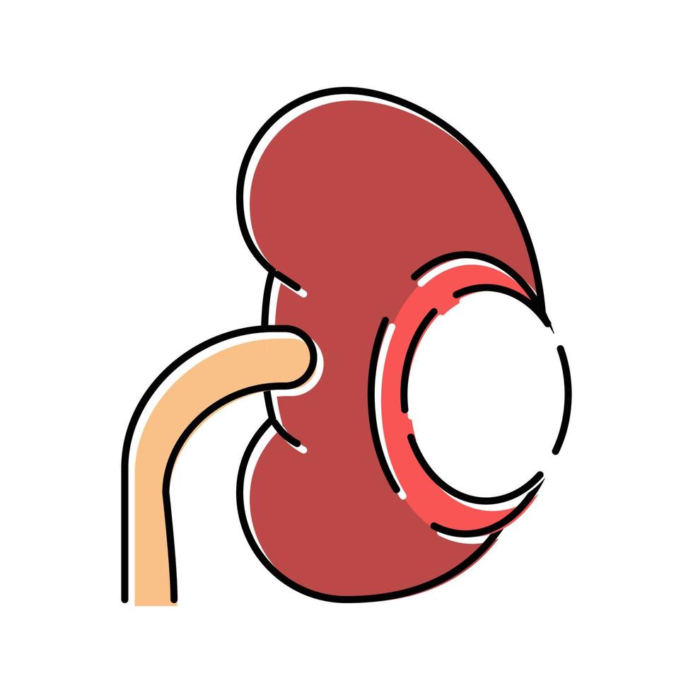 ilustración de vector de icono de color de quiste renal