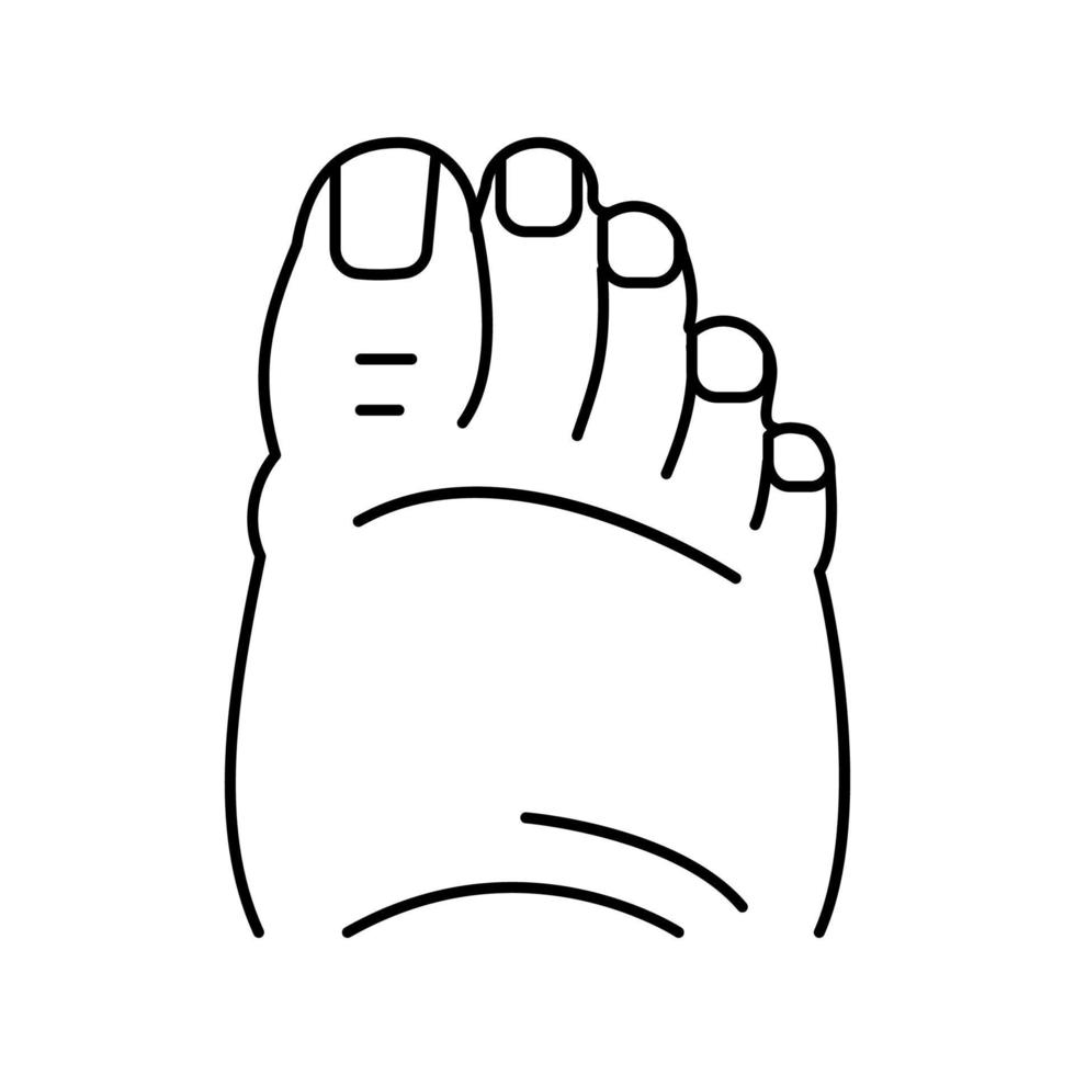 fatty foot edema line icon vector illustration