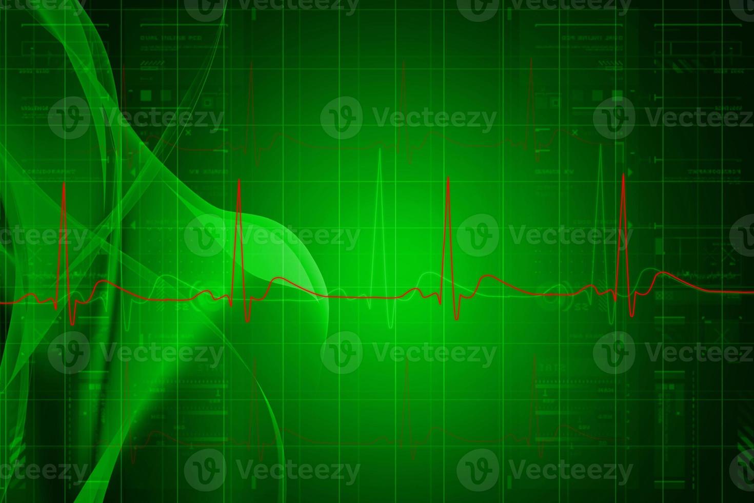 Digital illustration of heart monitor screen with normal beat signal photo