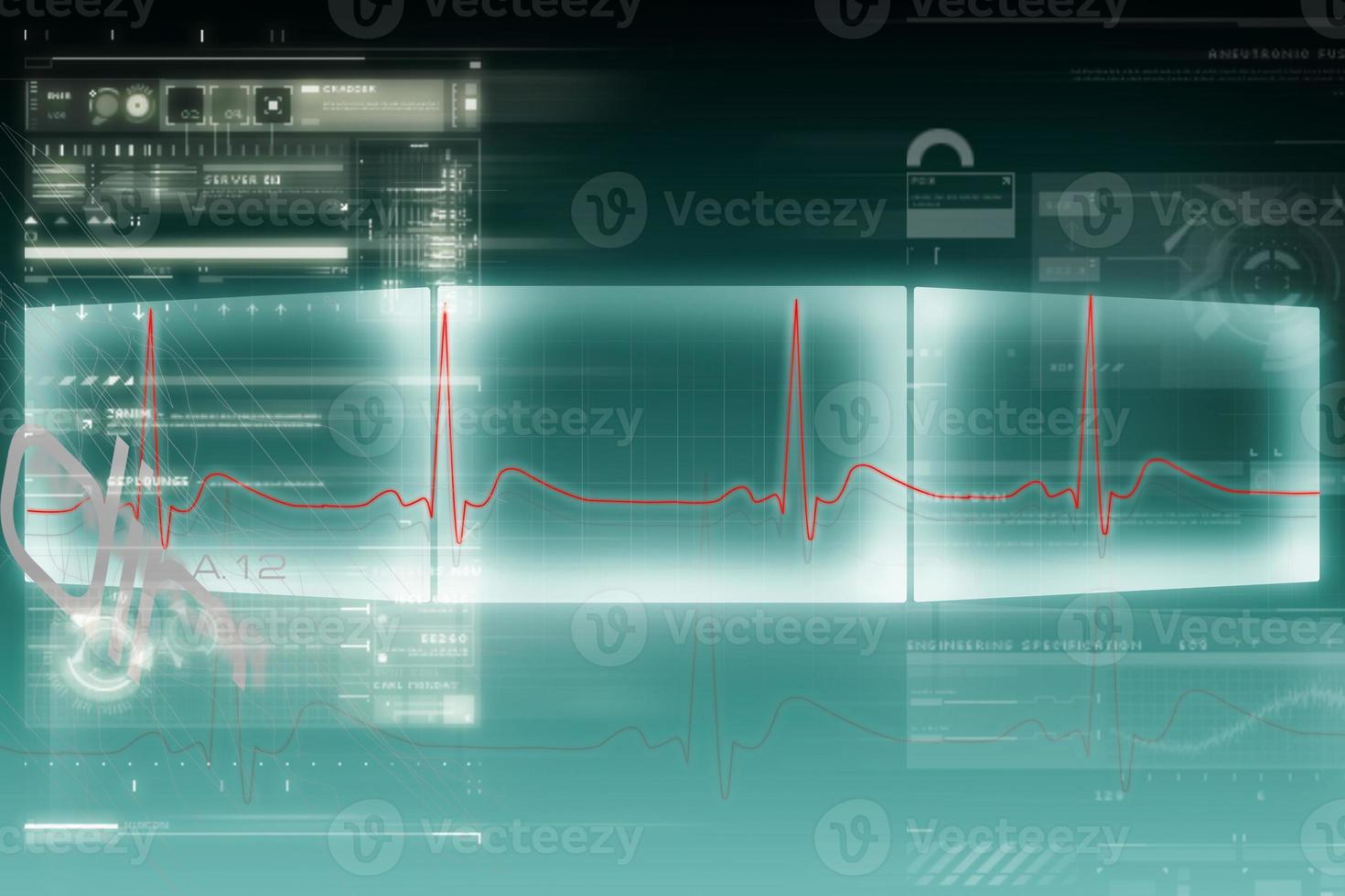 Digital illustration of heart monitor screen with normal beat signal photo