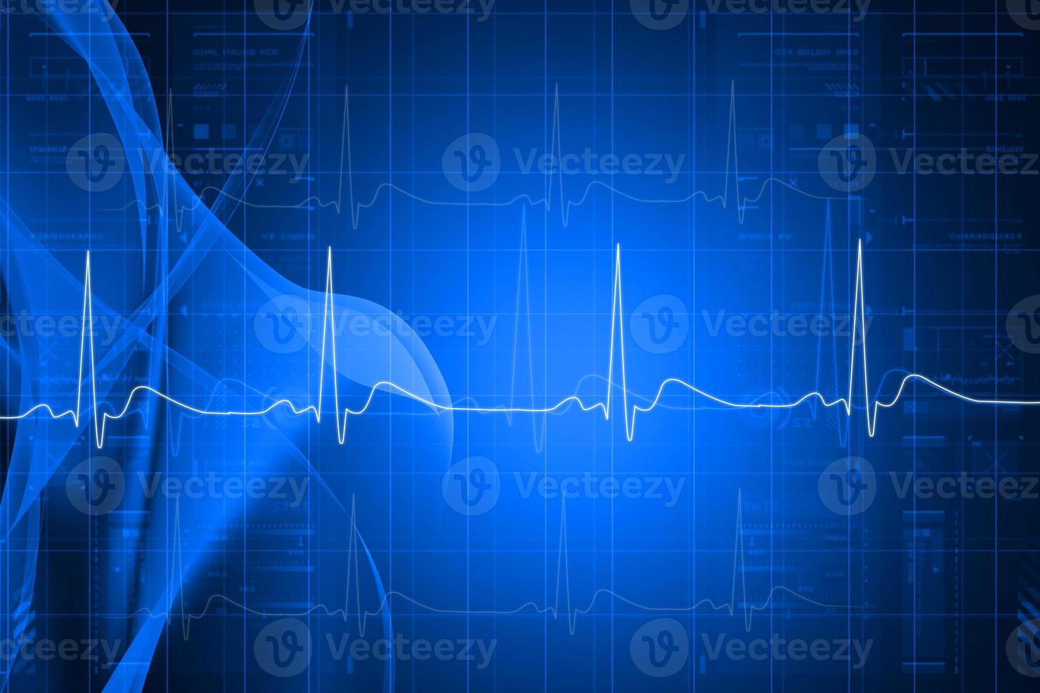 Digital illustration of heart monitor screen with normal beat signal photo
