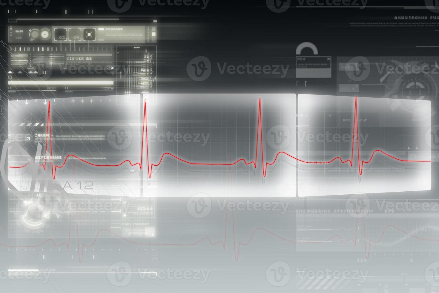Digital illustration of heart monitor screen with normal beat signal photo