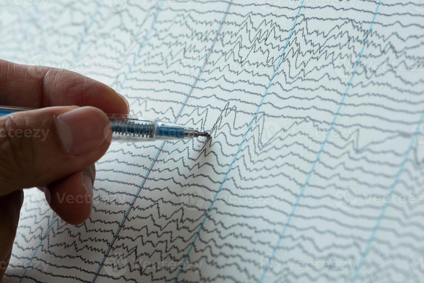 Doctor pointing at abnormal brain waves photo