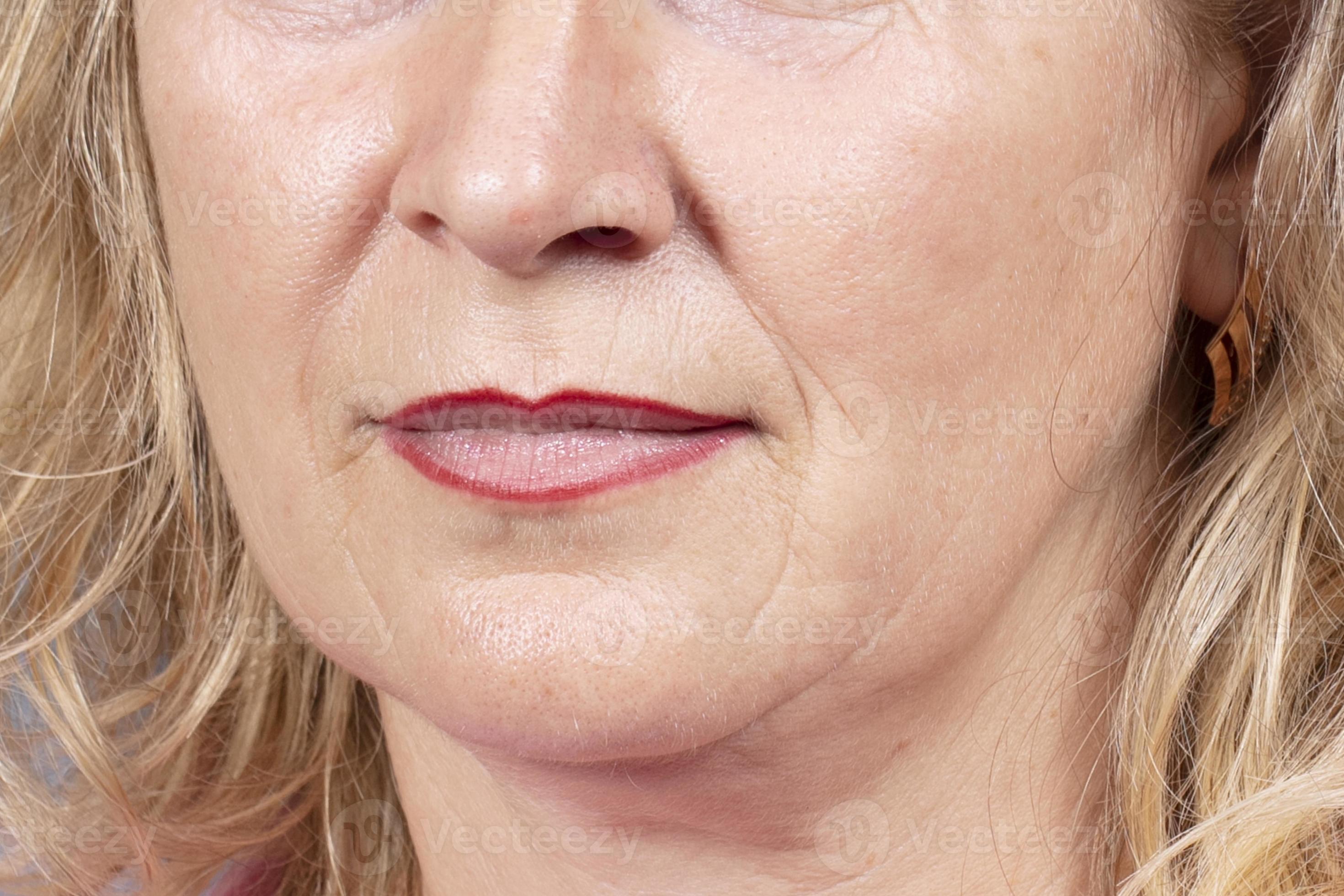 The lower part of the face and neck of an elderly woman with signs of