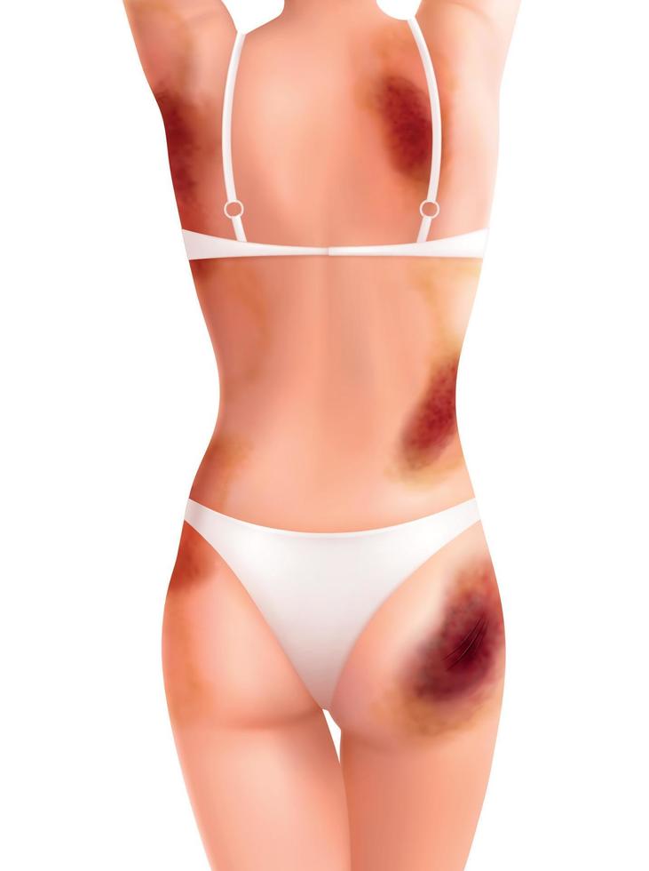 composición corporal de mujer lesionada vector