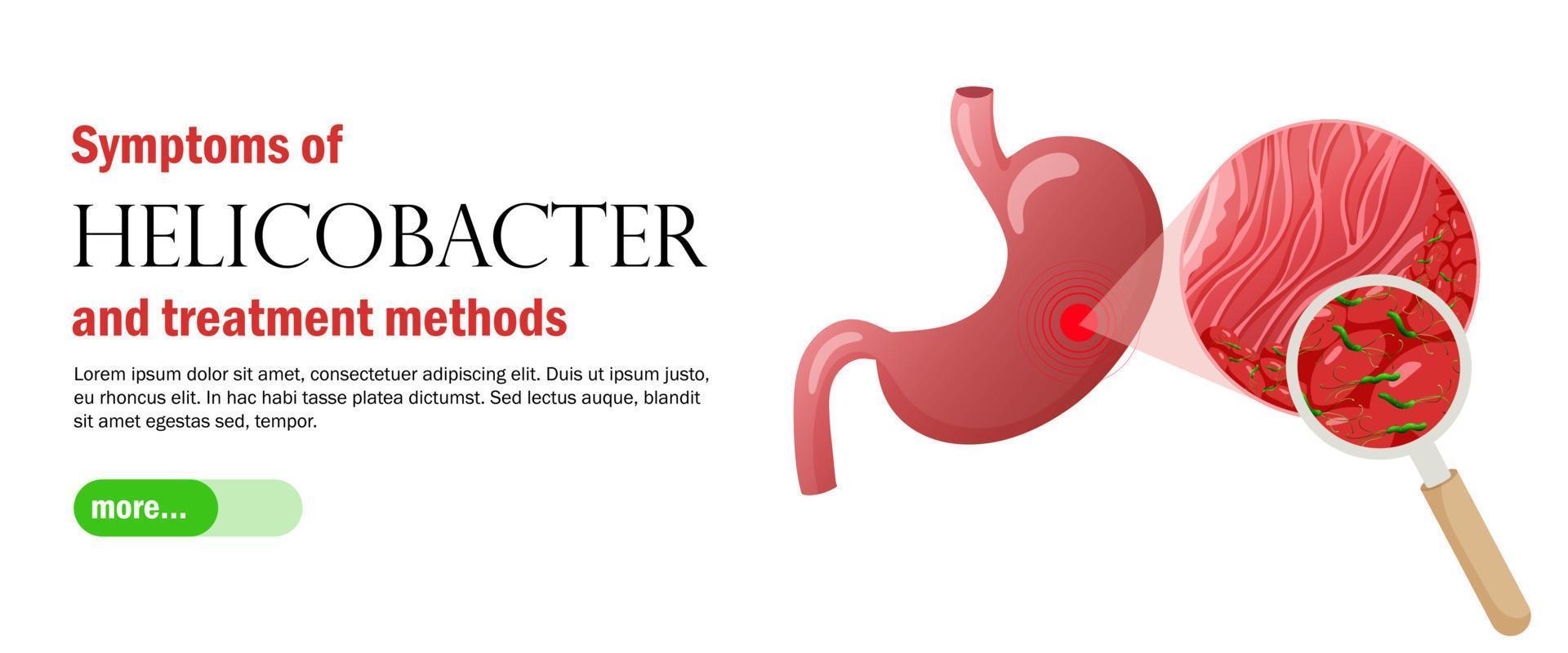 Gastritis and helicobacter pylori web banner template. Healthcare vector illustration cartoon style