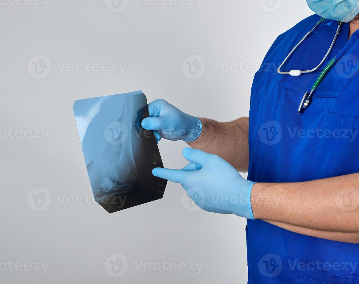 doctor in blue uniform and sterile latex gloves holds and examines X-ray of leg bone photo