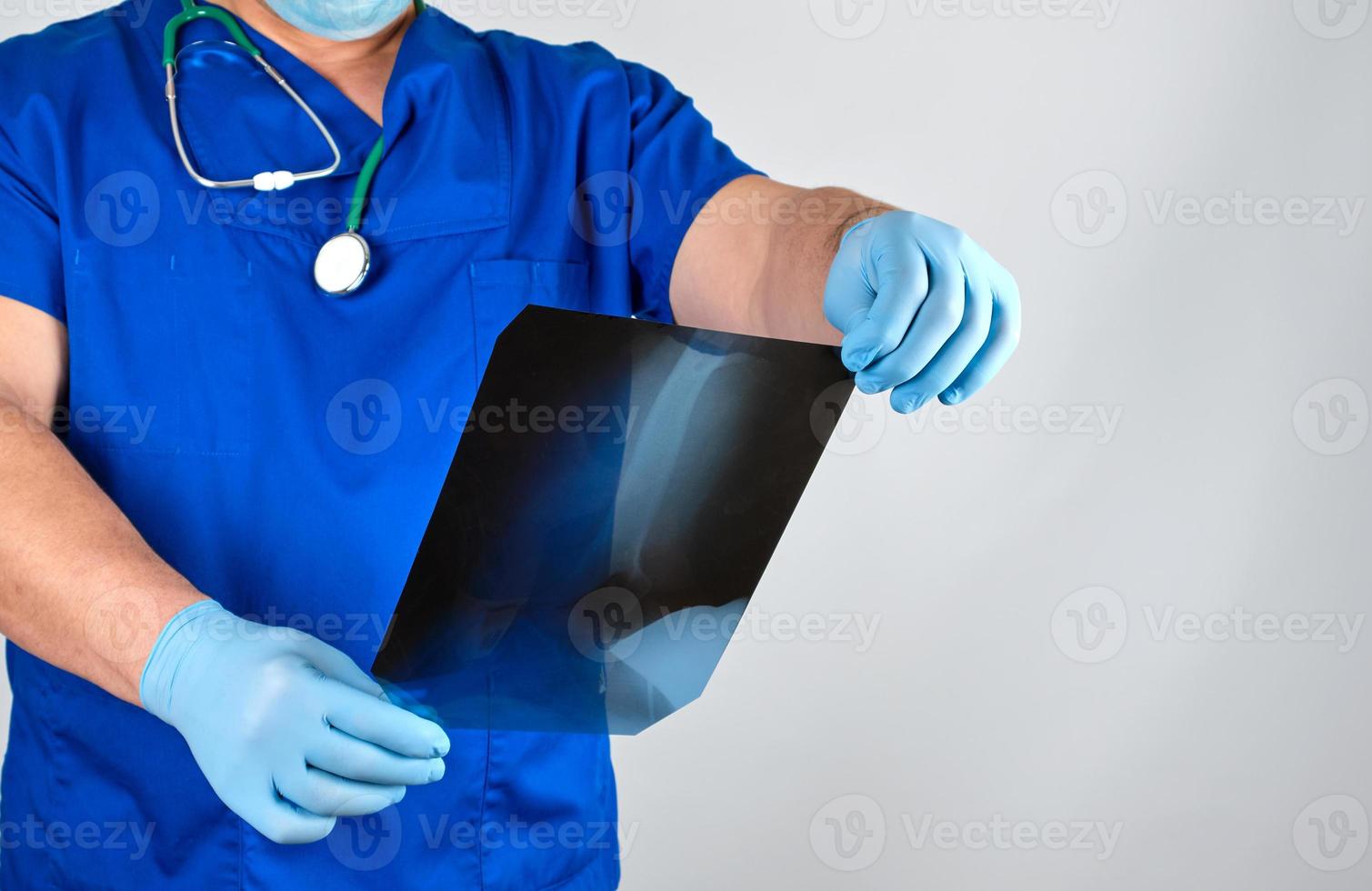 doctor in blue uniform and sterile latex gloves holds and examines X-ray of leg bone photo