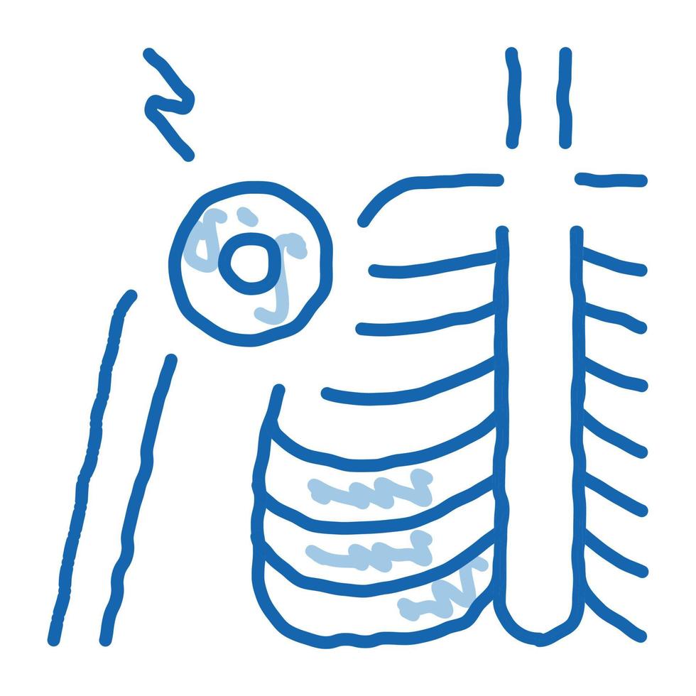arthritis of shoulder joint doodle icon hand drawn illustration vector