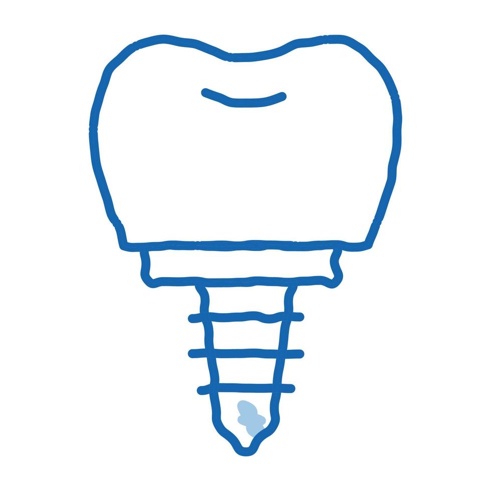 Dentist Stomatology Tooth Implant doodle icon hand drawn illustration vector