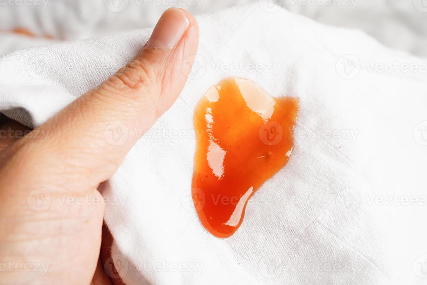 Dirty spicy sauce stain on cloth to wash with washing powder, cleaning housework concept. photo