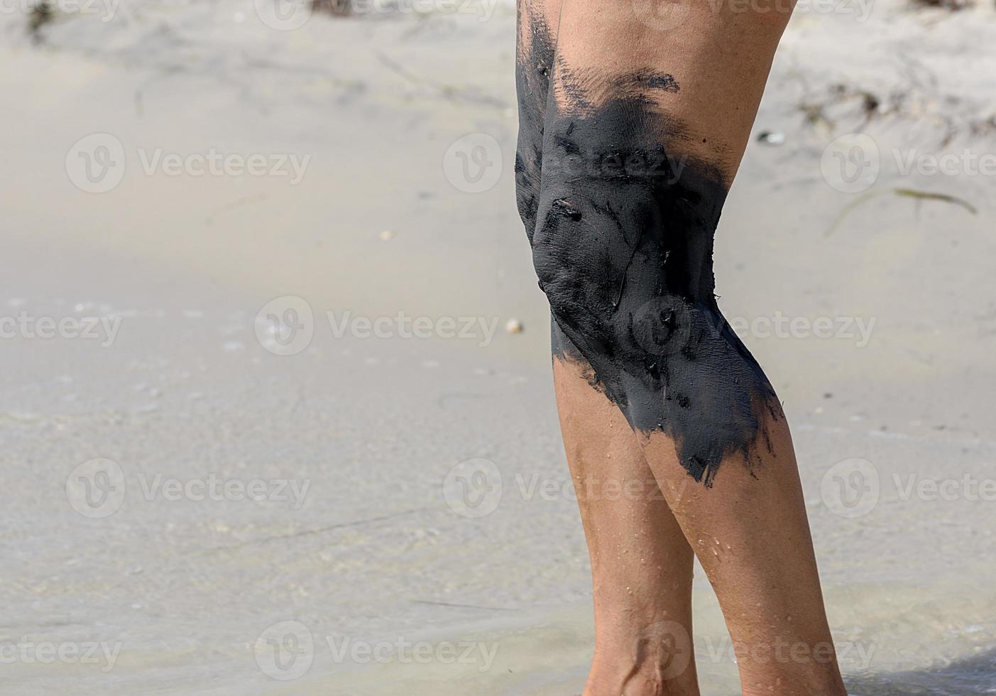 treatment of mud joints of feet on the seashore photo