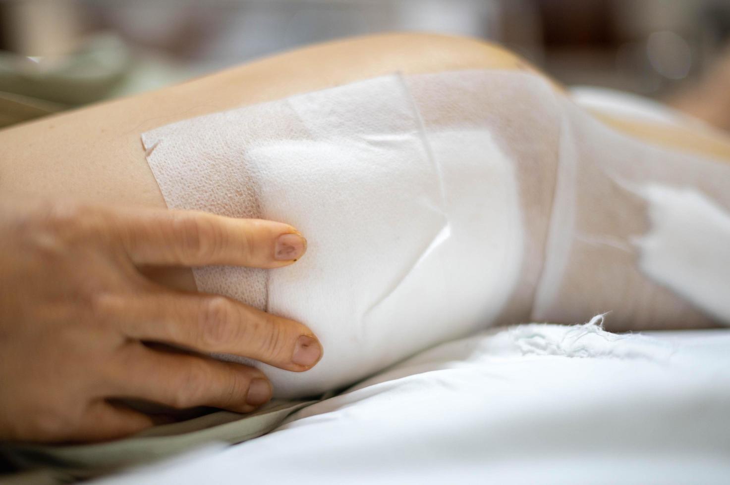 la anciana paciente muestra sus cicatrices cirugía de herida quirúrgica de la pierna rota en la cama en la sala del hospital de enfermería. foto