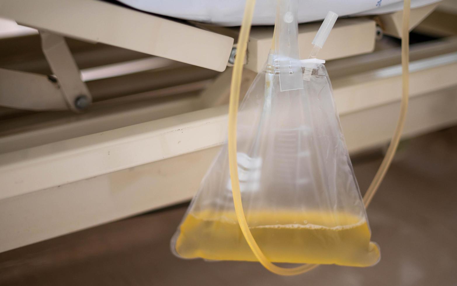 la bolsa del catéter de orina o orina cuelga debajo de la cama del paciente en el hospital. foto